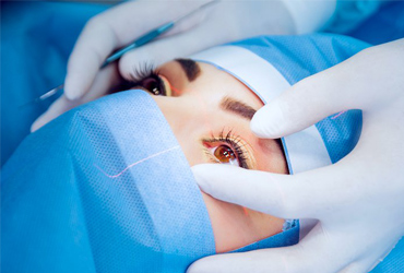 Рефракційна хірургія